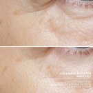 Babor ampuller Collagen booster thumbnail